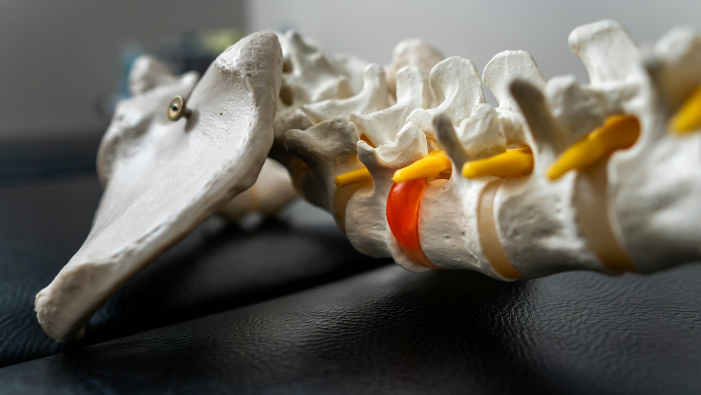 Modelo de columna vertebral lumbar con discos intervertebrales